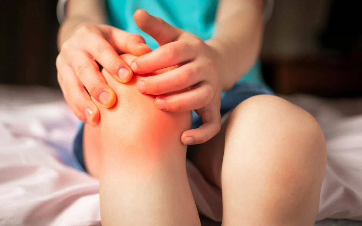 Системный ювенильный ревматоидный артрит. Вылечить артрит ребенку. Вальгусное плоскостопие у взрослых. Системные формы ювенильного ревматоидного артрита. Вылечить артрит ребенку.