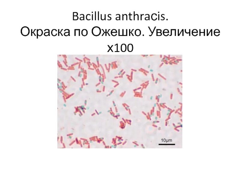 Ожешко микробиология. Ожешко окраска. bacillus по ожешко. bacillus окраска ожешко. окраска по ожешко микробиология.