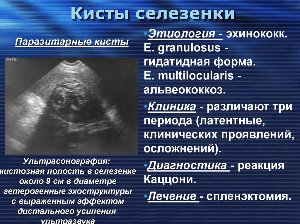 Кисты селезенки этиология. Паразитарная киста селезенки. Паразитарная киста селезенки УЗИ. Паразитарная поражение селезенки. Расширенная селезенка