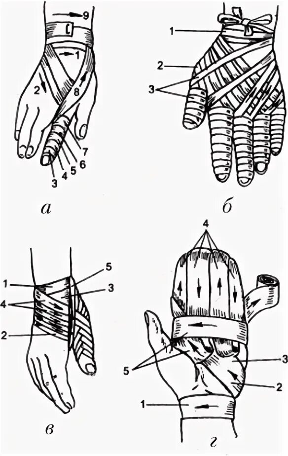 Техника наложения повязки перчатка. Рыцарская перчатка перевязка. Рыцарская перчатка десмургия. Бинтовая повязка перчатка. Десмургия повязка перчатка.