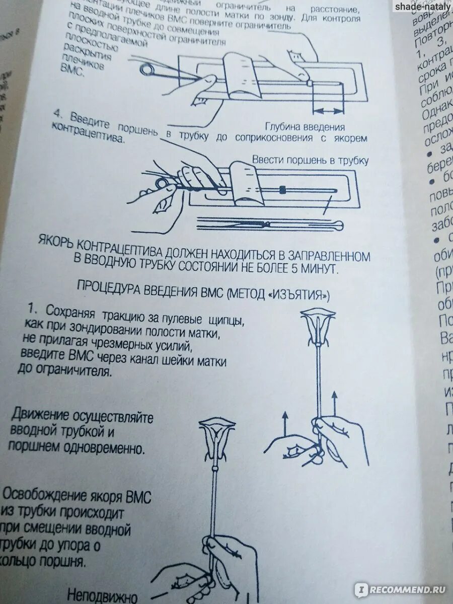 Введение вмс. Введение ВМС техника введения. Техника установки спирали Юнона. Введение ВМС Юнона.