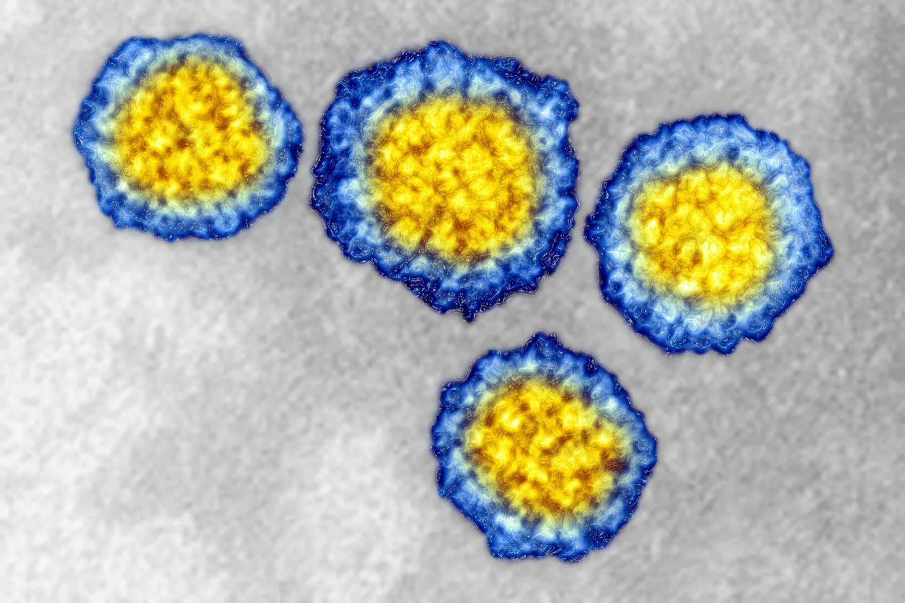 Papilloma virus