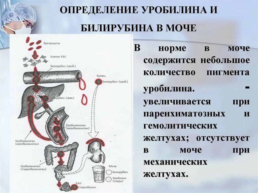 Уробилинурия. Билирубин уробилиноген. Билирубин и уробилин в моче. Определение уробилина в моче. Кристаллы билирубина в моче.