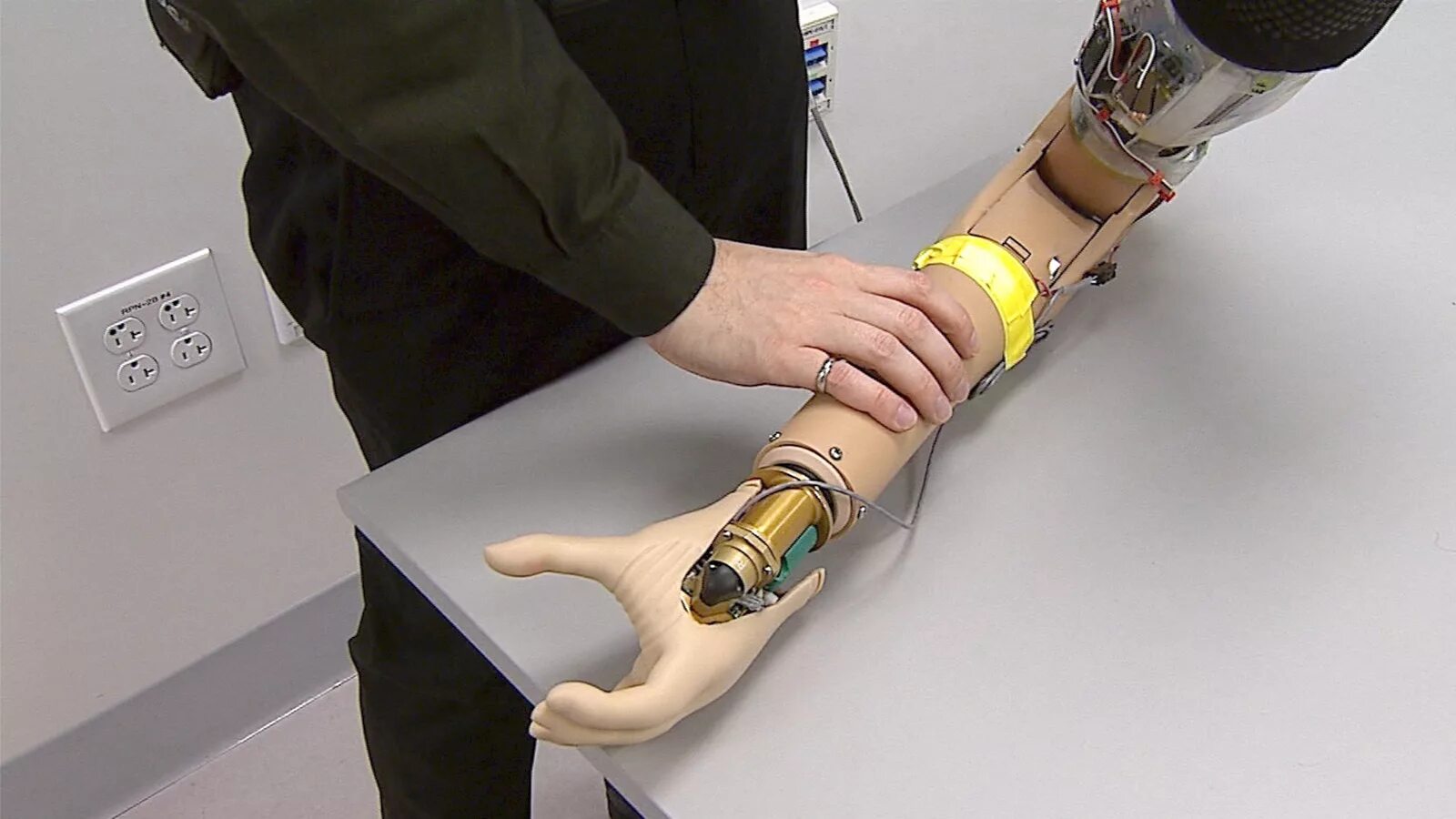 Бионические протезы конечностей. Touch Bionics протезы. Max Bionics протез. Бионический протез Bionic.