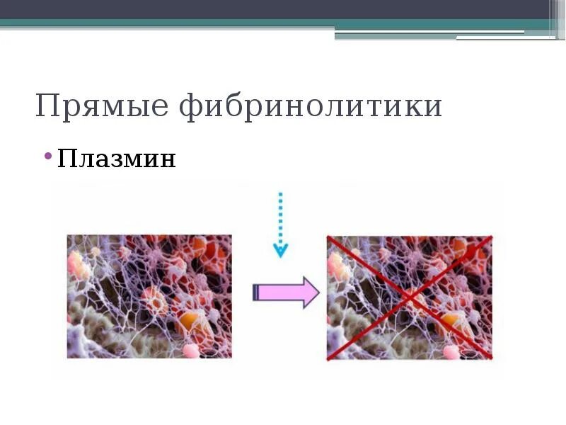 Фибринолитики это. Фибринолитики. Фибринолитики классификация. Фибринолитические ферменты. Фибринолитические ферменты при спайках в Малом тазу.