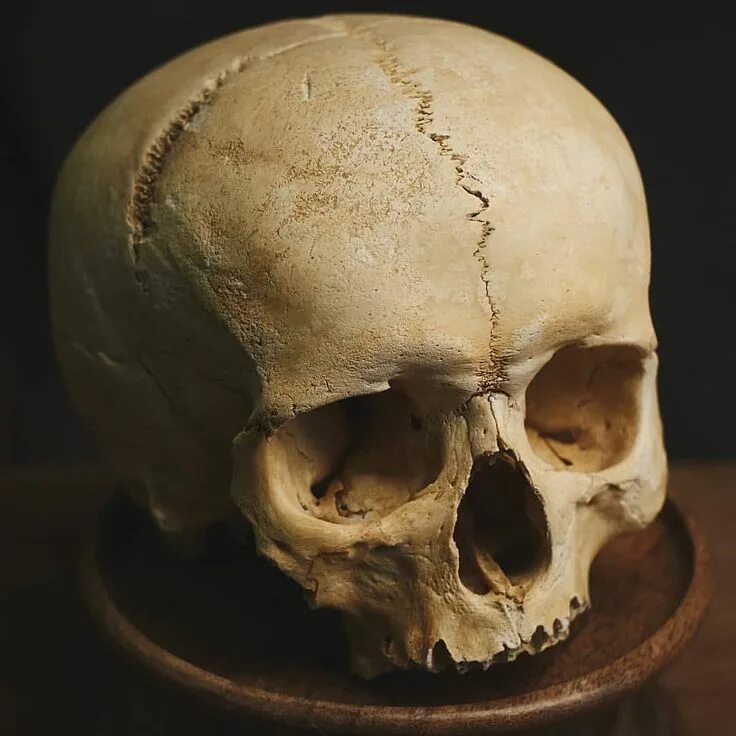 deformed human skulls Google Search Deformed human skull, Hatred, Human skull