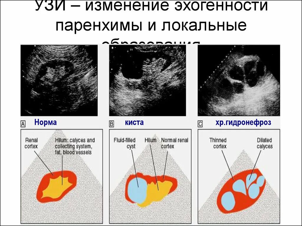 Что означает эхогенность печени. Шкала эхогенности УЗИ. Эхогенность паренхимы почек. Эхогенность на УЗИ.