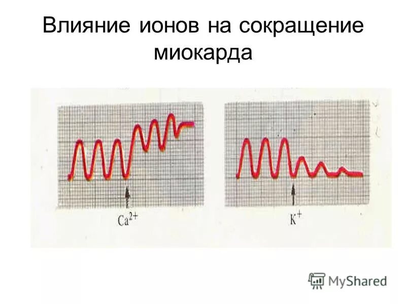 Механизм сокращения миокарда. Сокращение миокарда называется. Сокращение миокарда называется. Механизм сокращения сердечной мышцы. Сокращение миокарда называется.