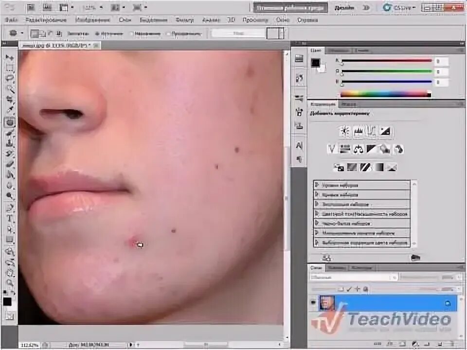 Симулятор удаления прыщей. Как убрать прыщи в адоб фотошоп. Как убрать прыщи у симов