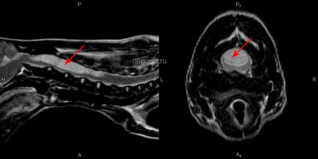 Мрт мозга собаке. Сирингомиелия у собак мрт. Сирингобульбия мрт. Сирингомиелия на мрт шейного отдела.