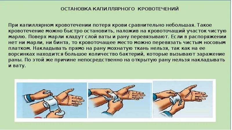 Сообщение первая помощь при кровотечениях. Сообщение первая помощь при кровотечениях
