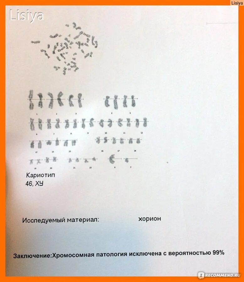 Результаты биопсии хориона. Заключение биопсии ворсин хориона. результат биопсии плода. результаты биопсии хориона расшифровка.