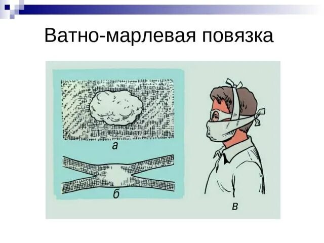 Наложить марлевую повязку. Схема изготовления ватно-марлевой повязки. Техника наложения повязки на глаз. Марлевая повязка. Ватно-марлевая повязка из бинта.