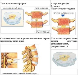 Элементы позвонка участвуют в образовании межпозвонкового отверстия