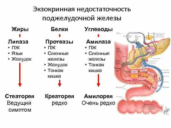 Недостаточная секреторная функция поджелудочной железы. Недостаточно ферментов поджелудочной железы симптомы. Недостаточность функции поджелудочной железы симптомы. Синдром экзокринной недостаточности.