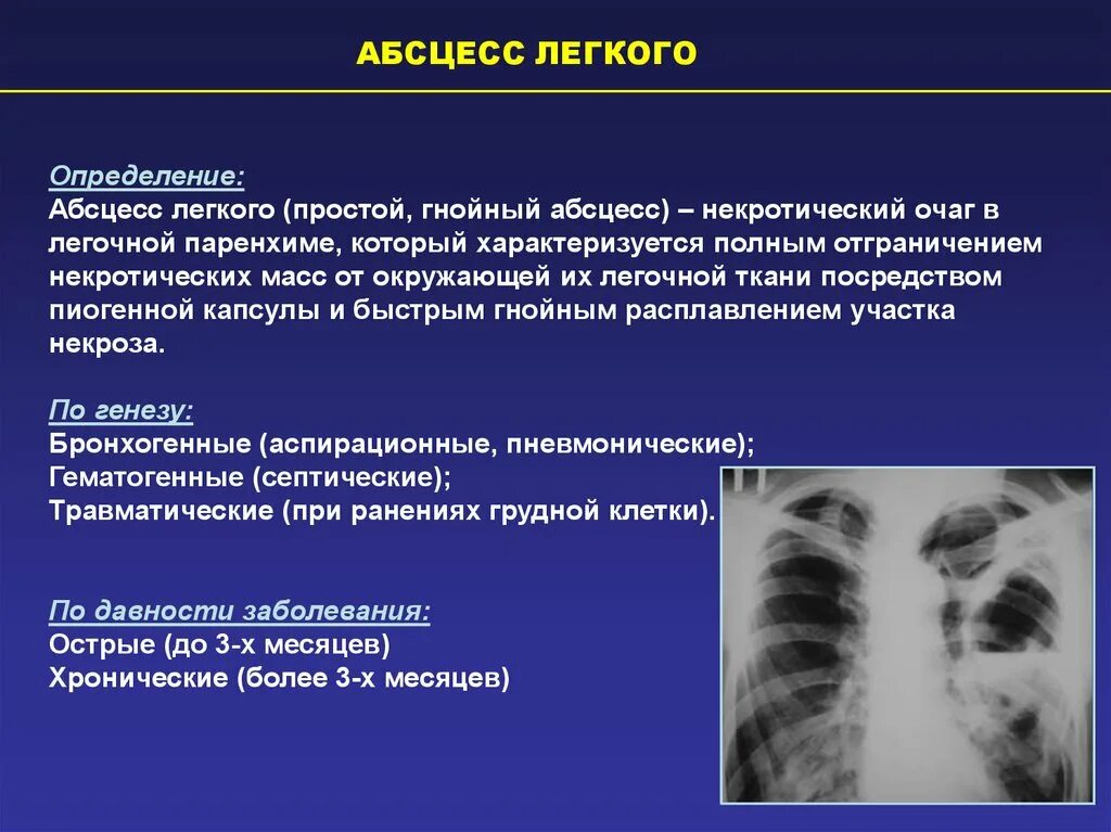 Лечение поражения легких