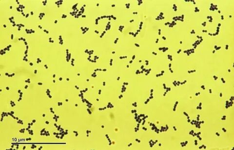 Peptostreptococcus