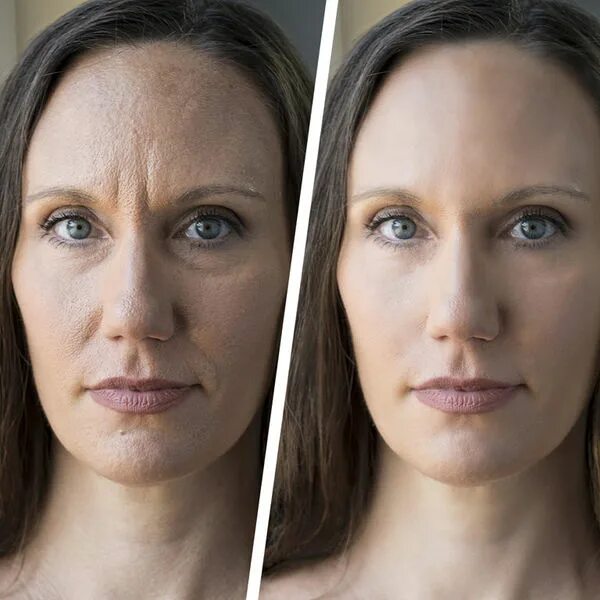 Лице 35. Морщины в 35 лет. Кожа лица в 40 лет. Морщины в 40 лет. Лицо женщины в 40 лет.