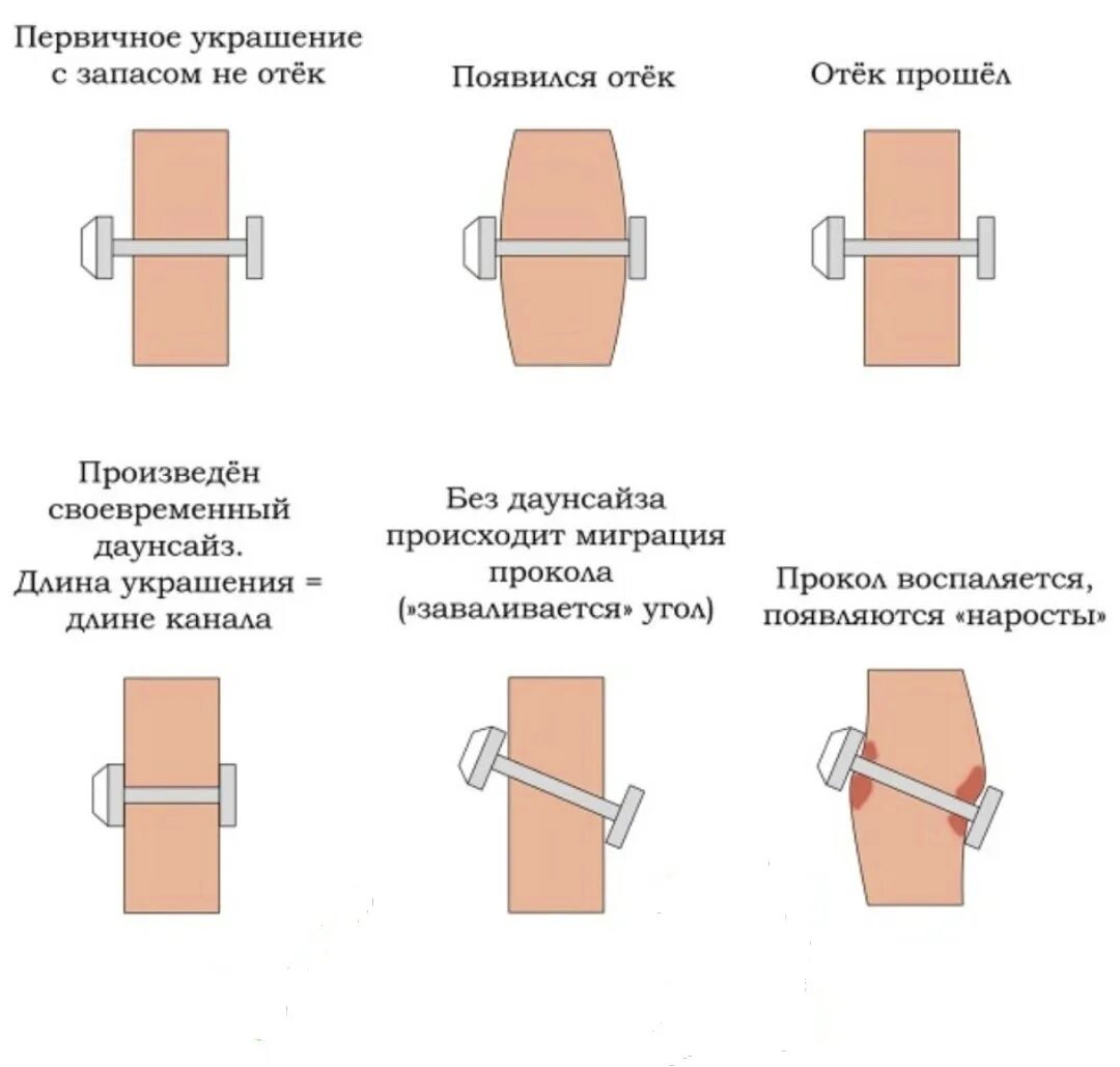 Даунсайз прокола Хеликс. Украшение после прокола. Даунсайз пирсинг