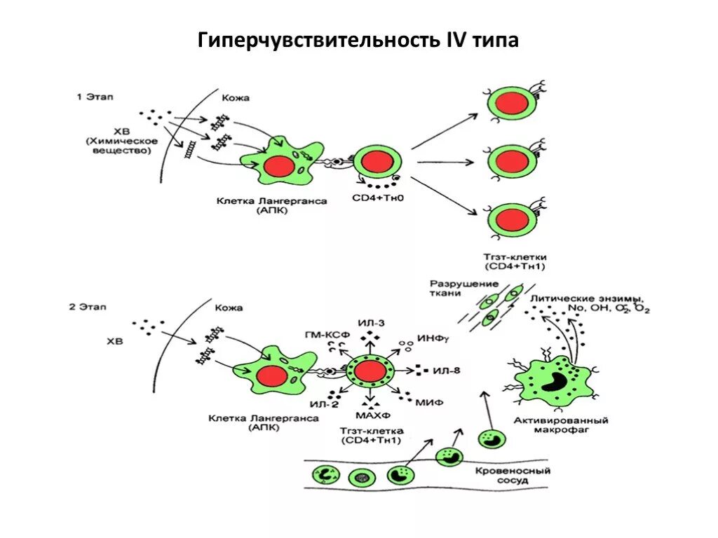 Иммунная гиперчувствительность. Схема реакции гиперчувствительности 4 типа. Реакция гиперчувствительность 4 типа. Реакция гиперчувствительности замедленного типа схема. Реакция гиперчувствительности 4 типа механизм.