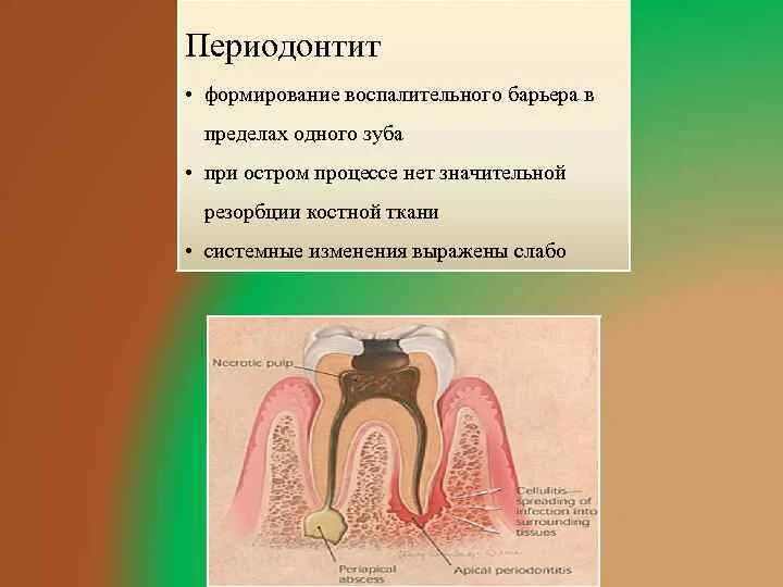 Осложнения периодонтита. Острый Гнойный периодонтит. Острый Гнойный периодонтит осложнения. Осложнение лечения периодонтита