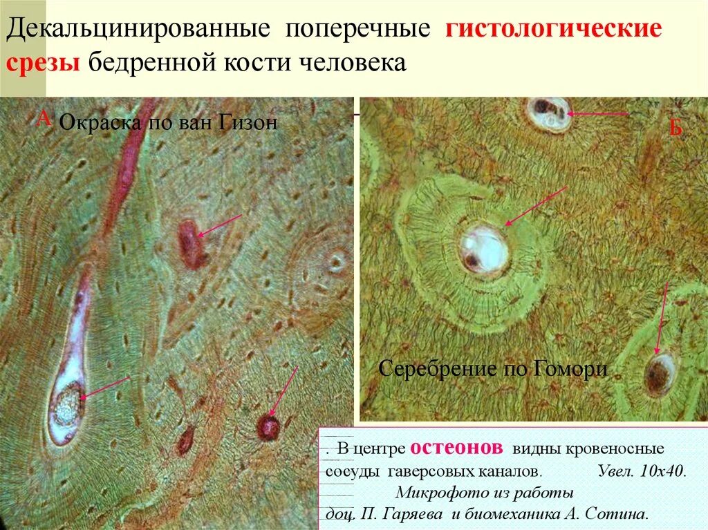 Срез кости. Пластинчатая костная ткань гистология поперечный срез. Поперечный разрез декальцинированной костной ткани. Поперечный срез кости гистология. Пластинчатая костная ткань гистология гаверсов канал.