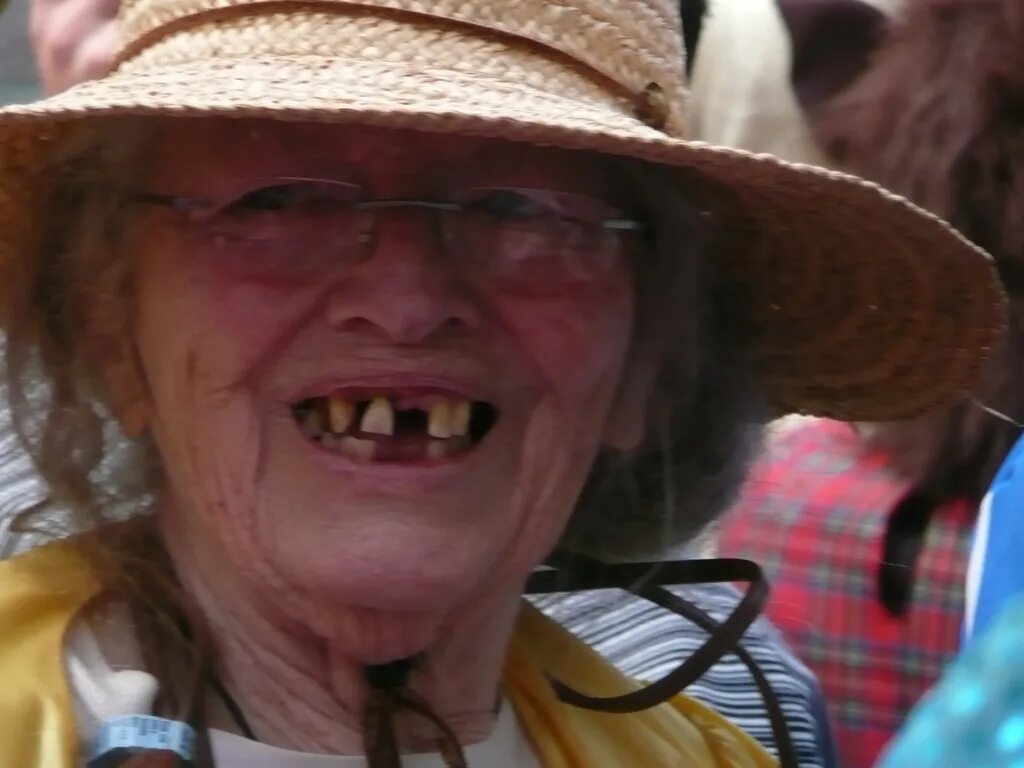 Oldest ugly
