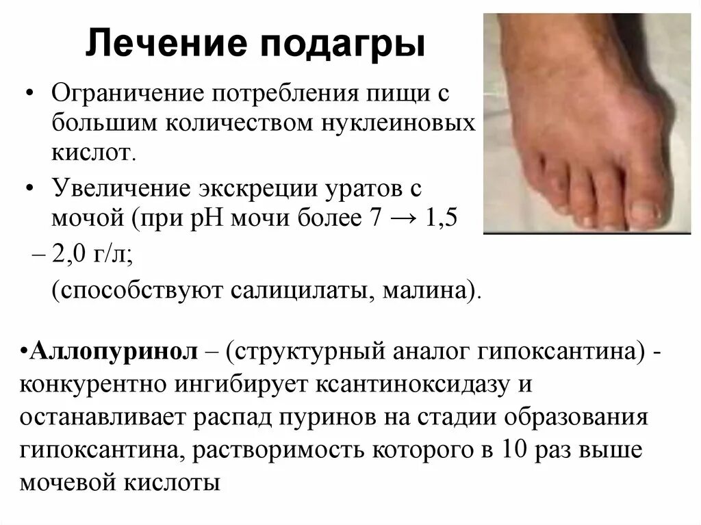 Какие компрессы можно делать при подагре