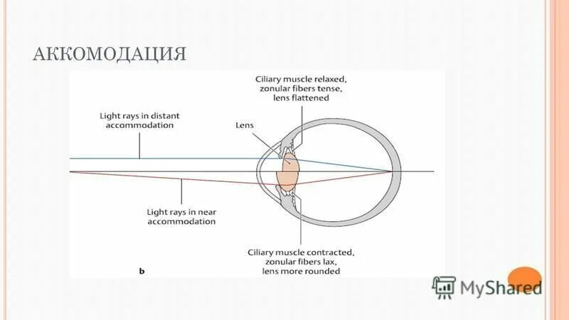 Аккомодация таблица. Аккомодация глаза осуществляется. Механизм аккомодации схема. Аккомодация хрусталика. Аккомодация рисунок.