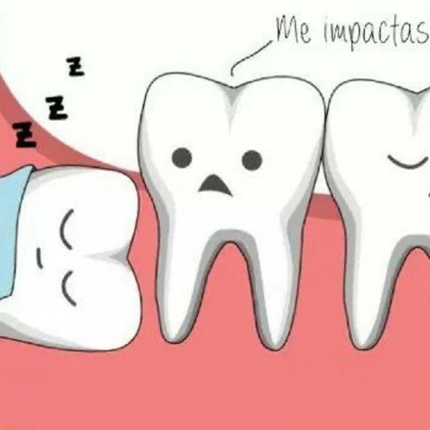 Как растет зуб мудрости. Зуб мудрости двигает зубы. Прорезание зуба мудрости. Ретинированный зуб мудрости. Зуб мудрости двигает зубы.