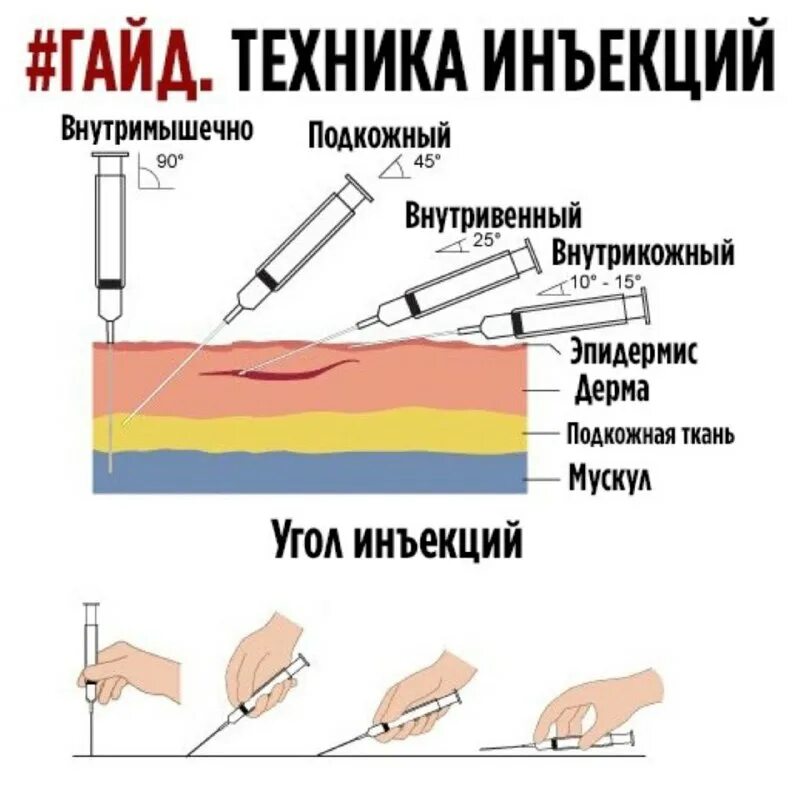 медуза необходима укол за уколом. набор из ампулы в шприц. медуза необходима укол за уколом. инъекция в ягодицу. прививка рисунок.