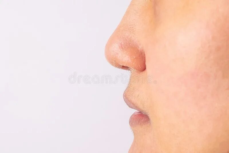 Dry nose. Dry nose