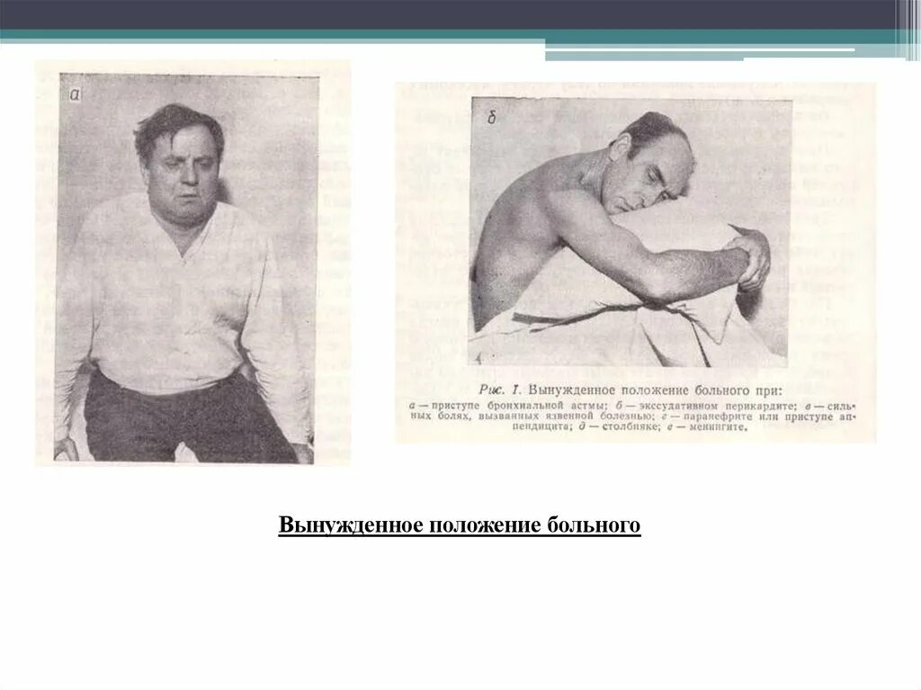 Положение при астме. Положение больного. вынужденное положение больного. вынужденное положение больного при перикардите. положение больного при выпотном перикардите.