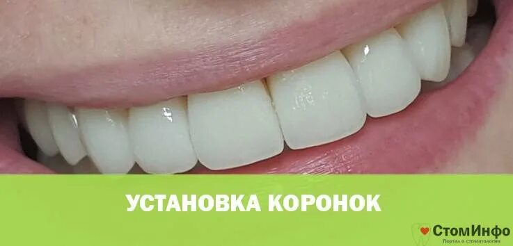 коронки диоксид циркония передние. коронка из диоксида циркония. коронка диоксид циркония и металлокерамика. коронка диоксид циркония полная анатомия. плюсы и минусы циркониевых коронок.