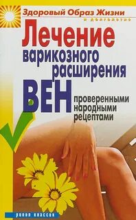 Лечение варикозного расширения