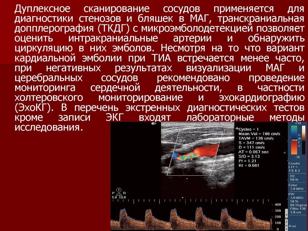 Транскраниальные артерии и вены. Транскраниальная ультразвуковая допплерография. Заключение транскраниальная допплерография сосудов головного мозга. Дуплексное исследование транскраниальных сосудов (голова). Дуплексное и триплексное сканирование сосудов.