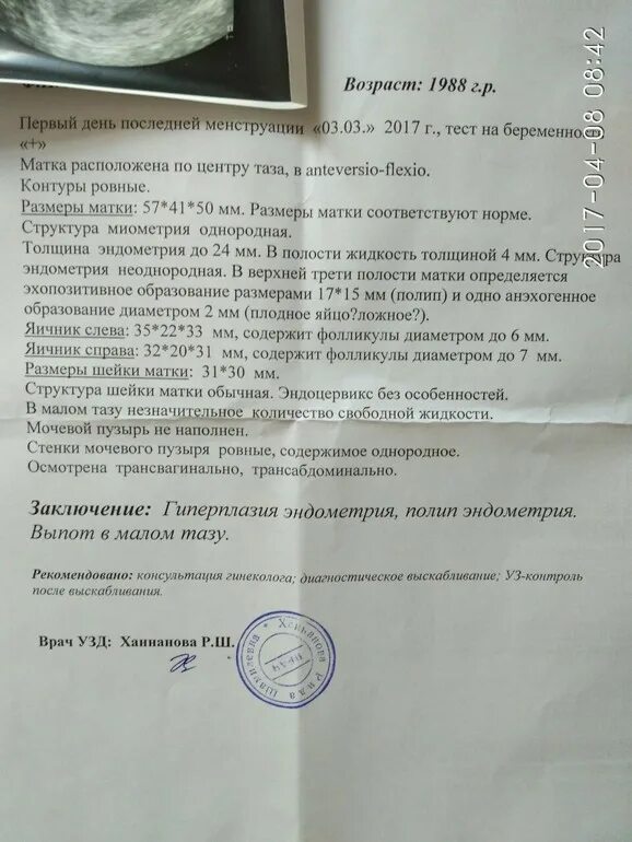 Можно ли забеременеть при полипе в матке