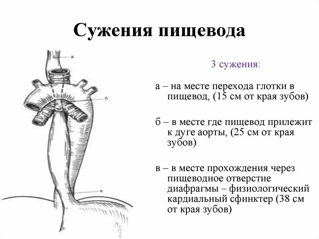 Анатомические сужения пищевода. Сужения пищевода анатомические и физиологические. Физиологические сужения пищевода схема. 3 Анатомических сужения пищевода.