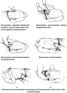 Пальпация кишки