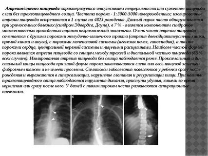 Стеноз у новорожденных