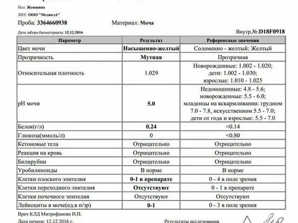 Белок в моче 0 150
