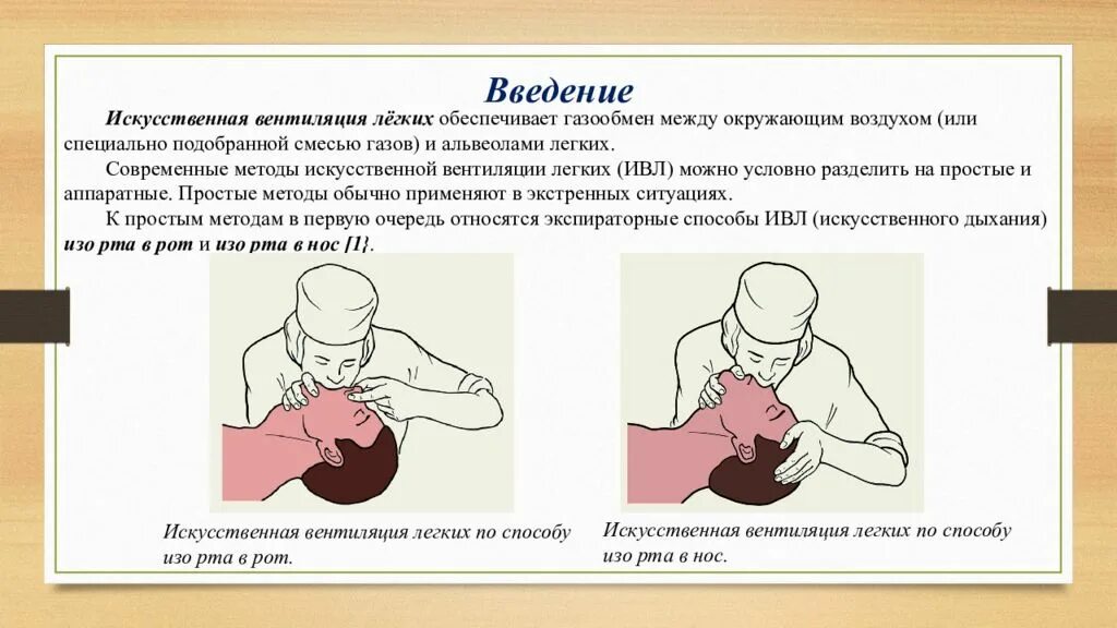 Искусственное дыхание проводится в следующих случаях. Механизм искусственной вентиляции легких. Искусственная вентиляция легких (ИВЛ).