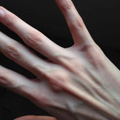 Тонкий пальчик. Арахнодактилия паучьи пальцы. Арахнодактилия паучьи пальцы тонкие. Арахнодактилия паучьи пальцы Эстетика. Длинные пальцы.