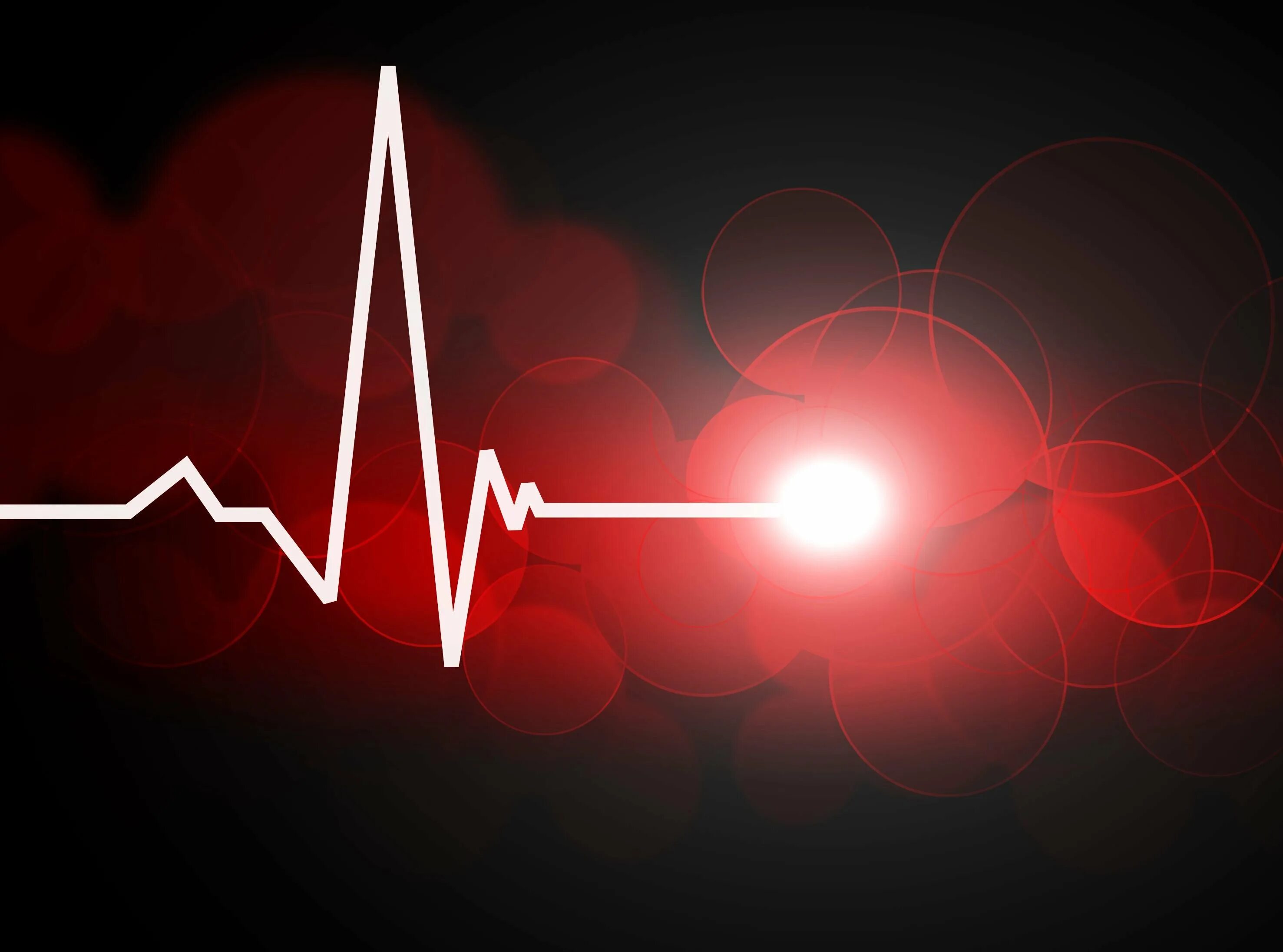 Эффект сердцебиения. Кардиограмма сердца. Пульс. Кардиограмма остановки сердца. Сердцебиение кардиограмма.