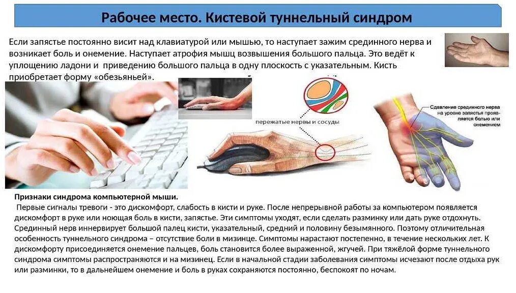 Запястный туннельный синдром. Туннельный синдром запястья кисти. Туннельный синдром пальцев. Туннельный синдром запястья кисти руки симптомы