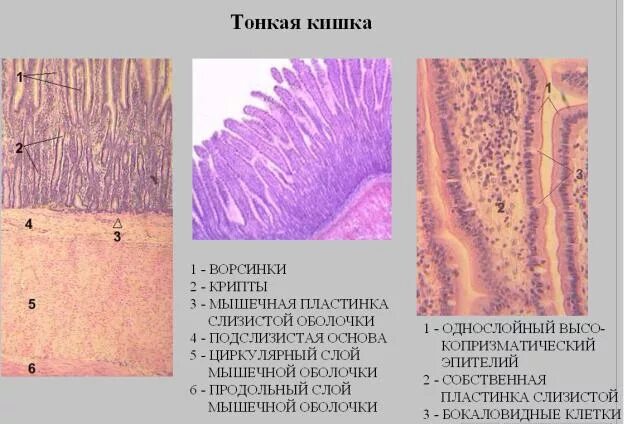 Препарат двенадцатиперстной кишки гистология. Срез двенадцатиперстной кишки гистология. Клетки толстой кишки гистология. Эпителий тонкой кишки гистология. Наличие ворсинок в слизистой оболочке