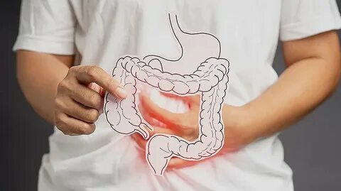 Gastrointestinal