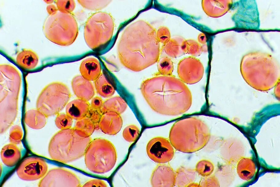 Митохондрии микроскопия. Лейкопласты в клетке. Лейкопласты микроскоп. Лейкопласты микроскоп. Митохондрия в электронном микроскопе.