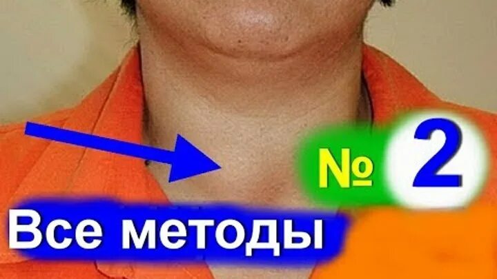 Щитовидная железа лечение народными средствами отзывы. Народные средства от щитовидки. Щитовидка народные средства. Лечусь дома. Средство от узлов на щитовидке.