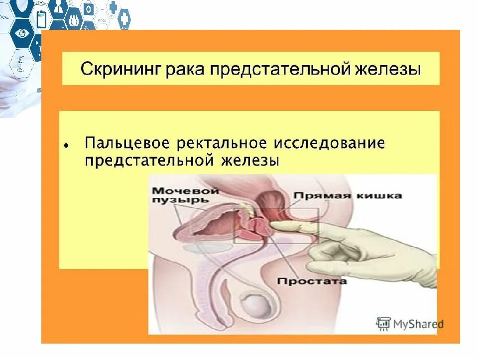 Ректальный человек. Ректальное исследование предстательной железы. Пальцевое исследование предстательной железы. Пальцевое ректальное исследование предстательной железы. Скрининг предстательной железы.